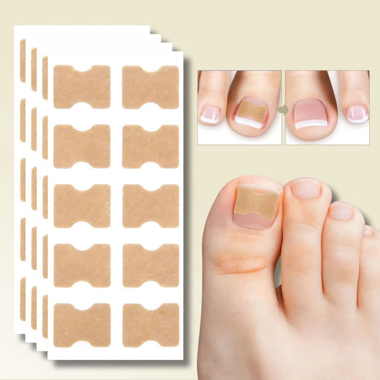 Ingrown Toenail Corrector Tool Nail Patches