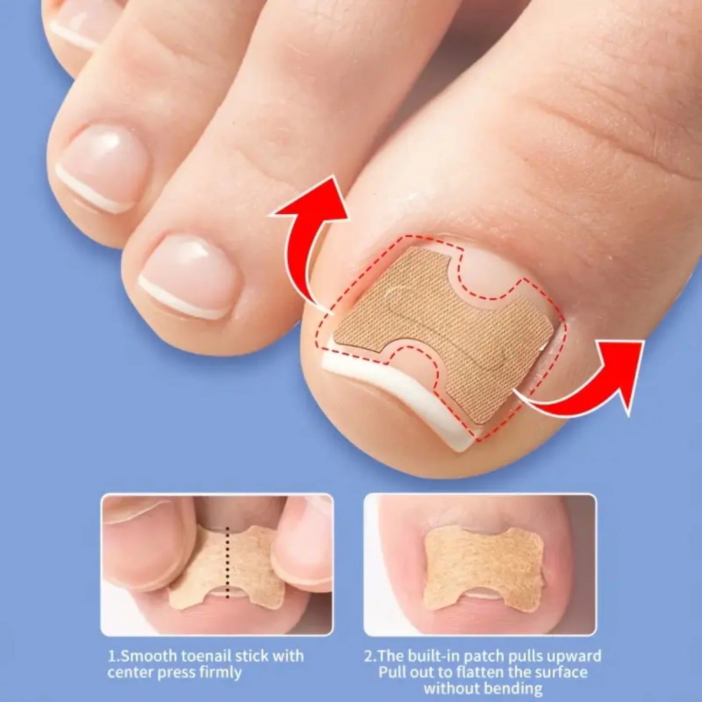 Ingrown Toenail Corrector Tool Nail Patches